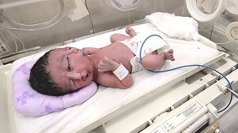 В Пакистане родился двуликий младенец ... 