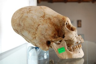 Вытянутые черепа из Паракаса имеют в ДНК необычную мутацию