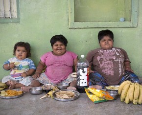 Из-за редкого генетического сбоя три индийских ребенка страдают сильным ожирением