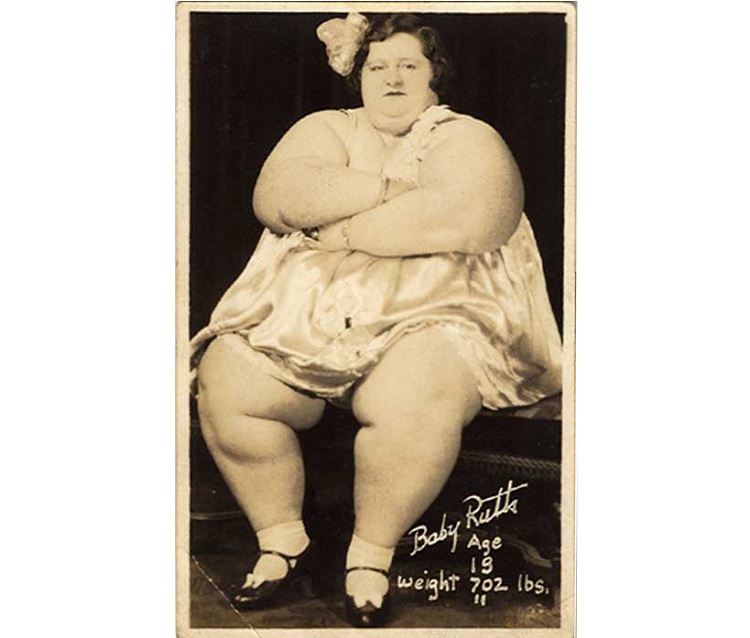 Похудение самых толстых людей