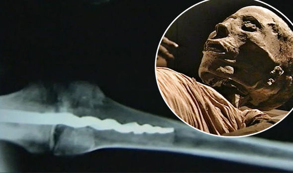 Новая археологическая загадка: В мумии нашли следы уникальной операции