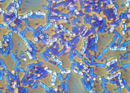 Ученые обнаружили бактерий, объединяющихся в своеобразный 