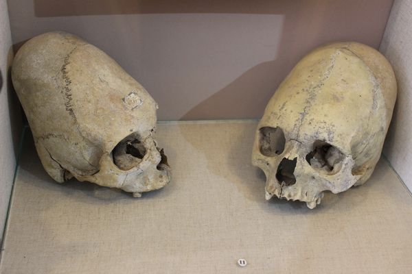 Вытянутые черепа из Крыма