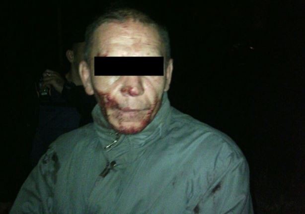 В Запорожье задержан мужчина, который напал на собаку с целью выпить ее кровь