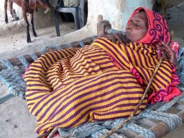 В Индии после рождения сына женщину скрючила неизвестная болезнь