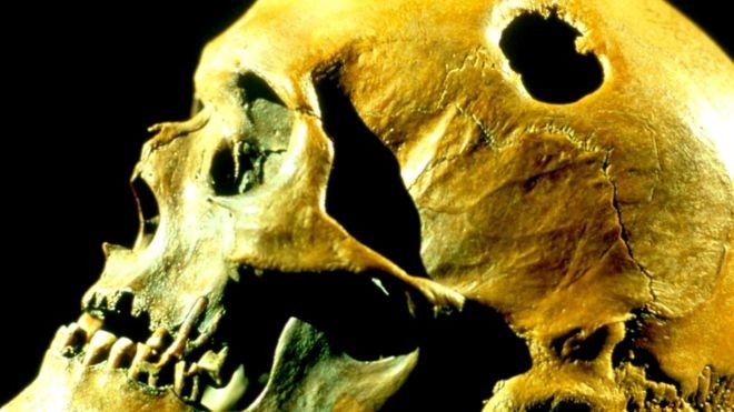 Зачем наши предки проделывали друг другу отверстия в черепе