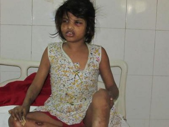 В Индии найдена одичавшая девочка 