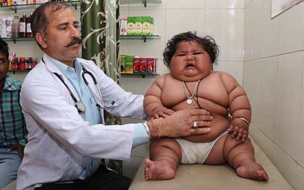 В Индии 8-месячная девочка весит как четырехлетний ребенок и ее вес все растет