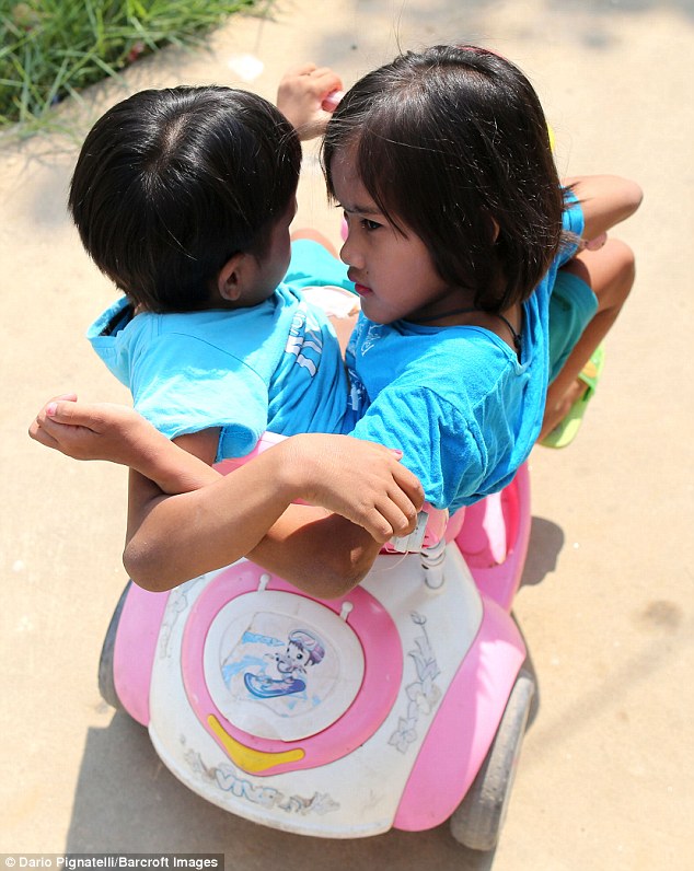 У 7-летних сиамских близнецов из Таиланда одна на двоих нижняя часть тела 