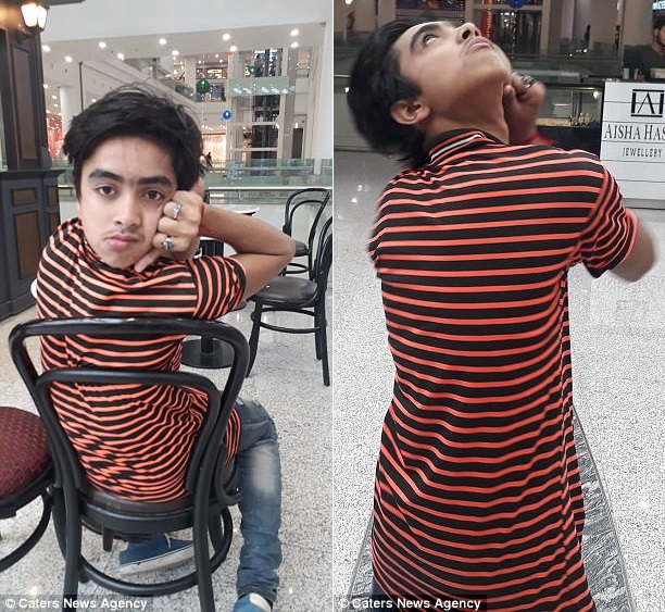 Пакистанский мальчик невероятным образом может выворачивать голову назад как сова 