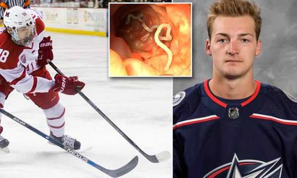 Хоккеист НХЛ пошел в туалет и внезапно обнаружил, что внутри него жил 63-сантиметровый червь