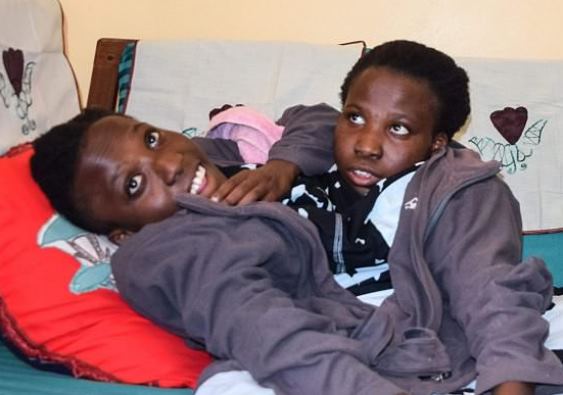 Танзанийские сиамские близнецы с одним телом на двоих скончались в 21 год