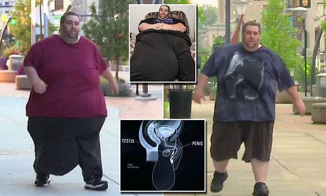 Мужчина 9 лет прожил с огромной мошонкой, весившей 36 кг