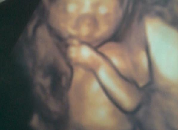 На снимке УЗИ разглядели руку бабушки, обнимающую ребенка в утробе