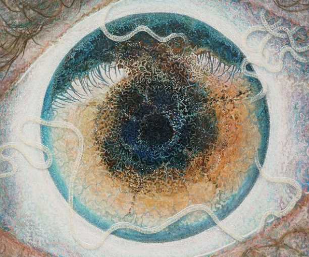 Художник нарисовал своих глазных червей, которых подцепил в Африке