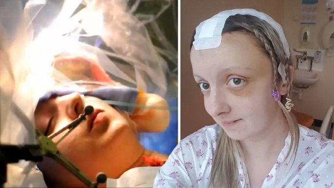 Женщина шутила и пела 9 часов подряд, пока ей делали операцию на открытом мозге