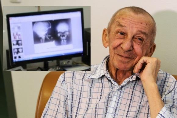 Новосибирские врачи помогли больному с очень редким Синдромом исчезающих костей