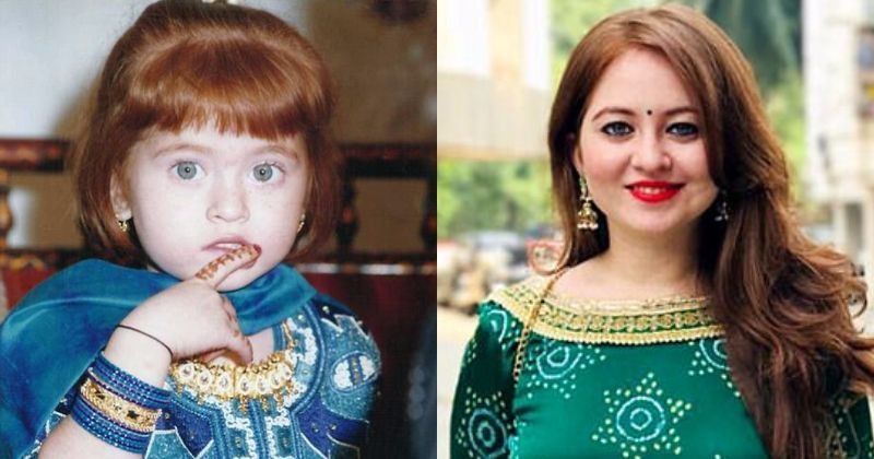 Родившуюся у обычных индийцев девочку с детства высмеивали за рыжие волосы и голубые глаза