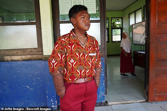 Самый толстый ребенок в мире потерял половину своего веса