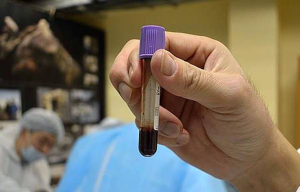 Ученые обнаружили жидкую кровь в теле замороженного 42 тысячи лет назад жеребенка