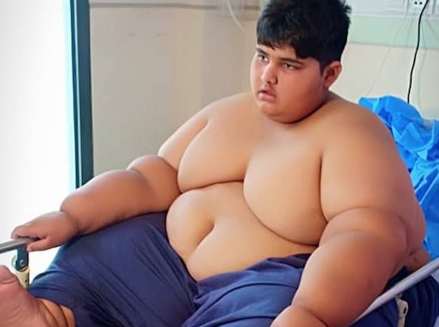 Новый самый толстый ребенок в мире нашелся в Пакистане