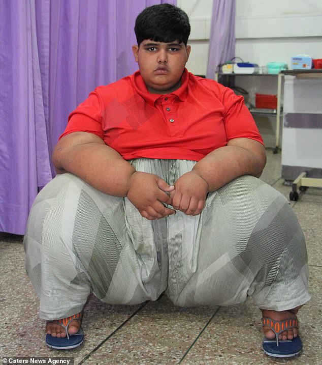 Новый самый толстый ребенок в мире нашелся в Пакистане