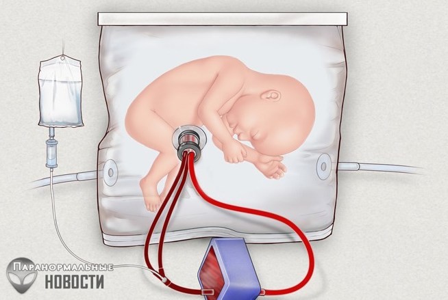 Через 5 лет недоношенных детей будут «подращивать» в искусственной матке
