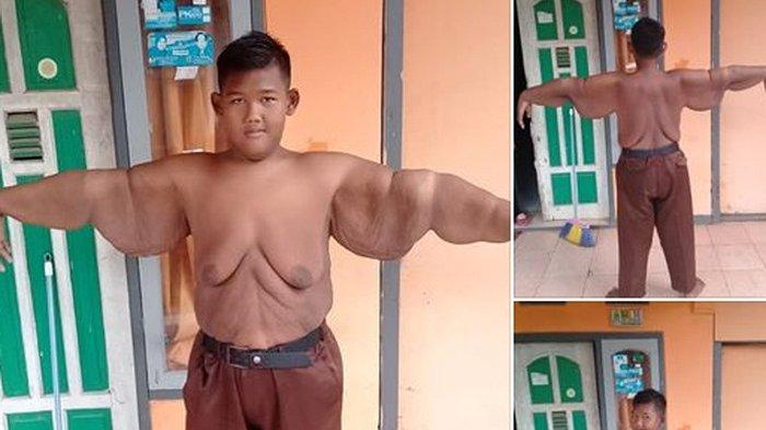 Как сейчас выглядит бывший самый толстый ребенок в мире 