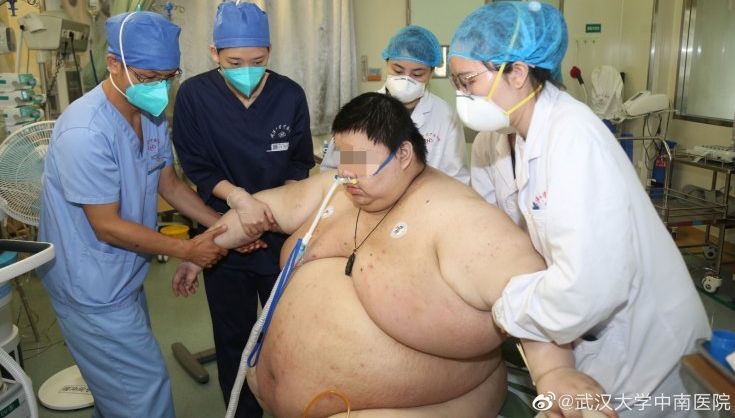 Самоизоляция за 5 месяцев превратила китайца в чудовищного толстяка