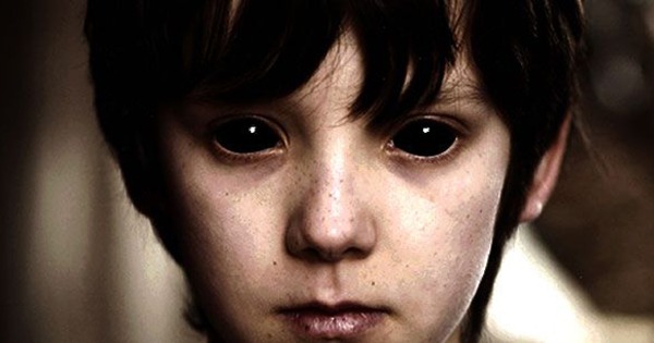Дети с Черными глазами: Темные существа или просто больные беспризорники?