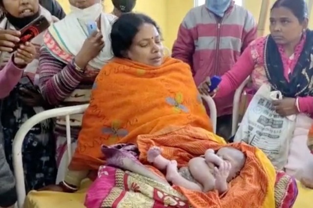 младенец, ребенок, новорожденный, четыре ноги, четыре руки, Индия
