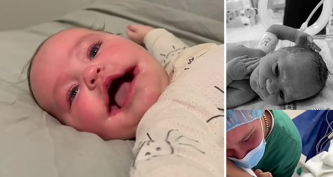 Девочка с огромным ртом родилась в Австралии