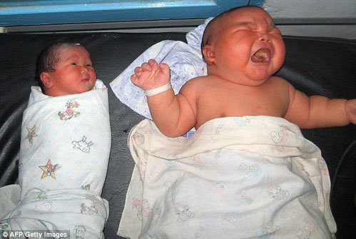 В Индонезии родился ребёнок-гигант