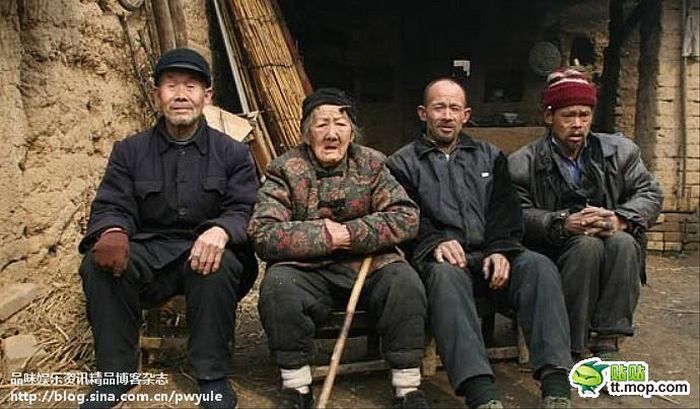 У 101-летней китаянки во лбу вырос рог (6 ФОТО)