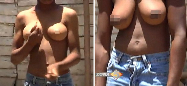 У мужчин из Доминиканской республики выросла женская грудь