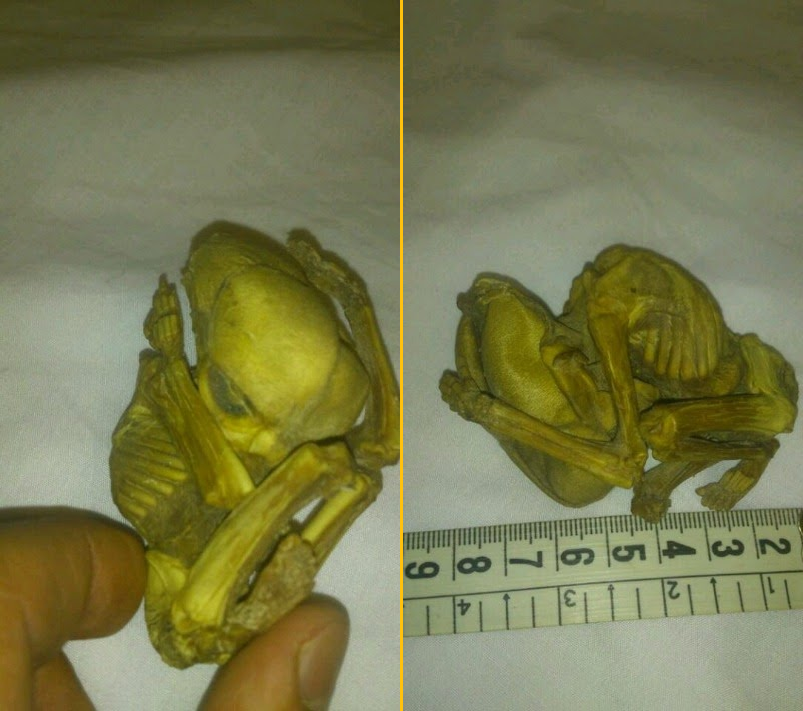 В Иране найден засохший эмбрион с вытянутым черепом. Ребенок-гибрид?