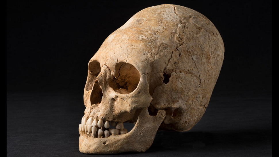 Во Франции тоже в древности деформировали черепа