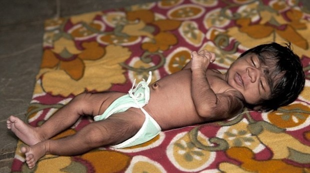 В индийской семье волосатых женщин родился волосатый младенец