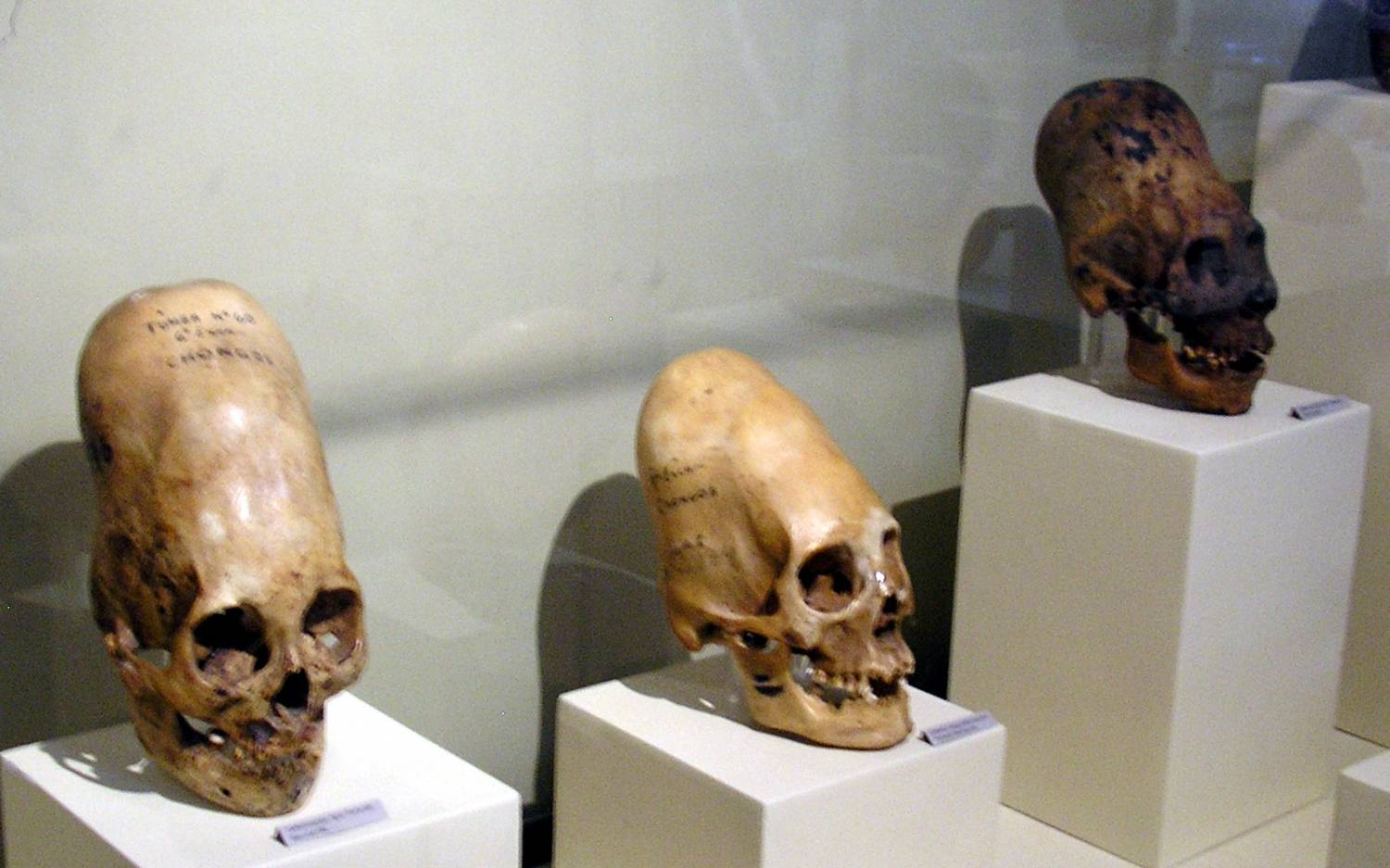 Вытянутые черепа из пустыни Паракас оказались со странным ДНК