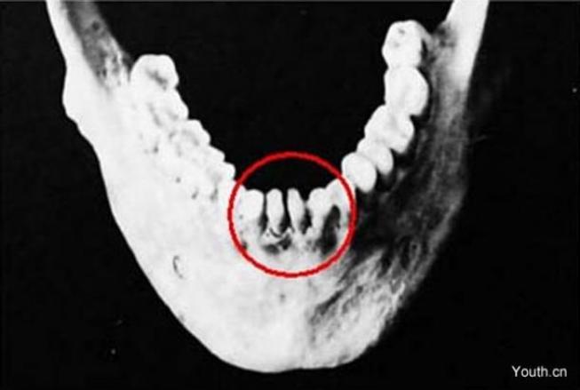 В Китае нашли череп со странными зубами