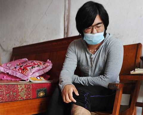 Заболевшие в реже. Женщина которая болеет редкой болезнью лица. Редкая болезнь в Китае где у девочки растет на коже стекла.