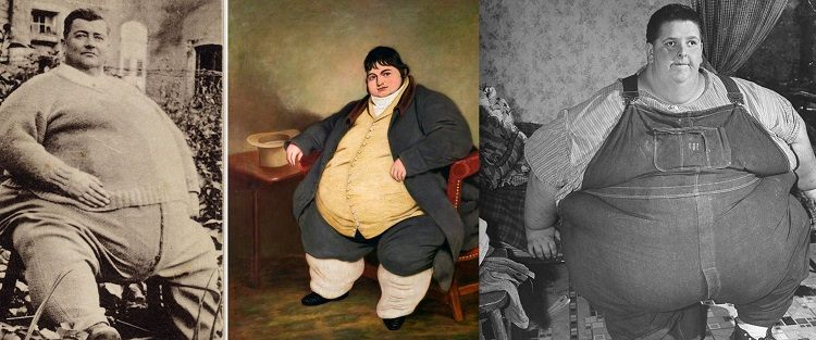 Толстяки в истории
