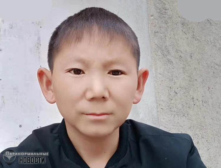 Из-за травмы головы 34-летний китаец до сих пор выглядит как ребенок