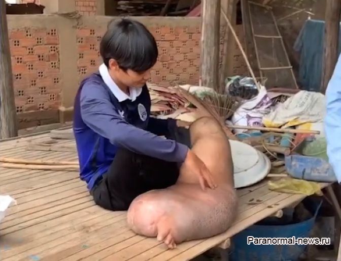 Укус комара превратил ногу камбоджийца в «раздутое тесто»