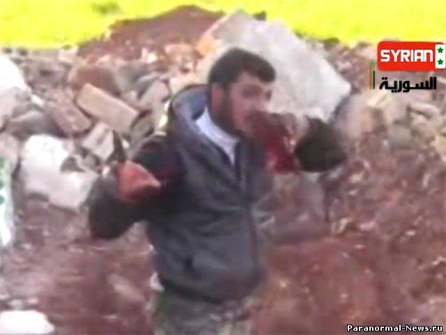 Сирийские людоеды: психопатия или информационная война?